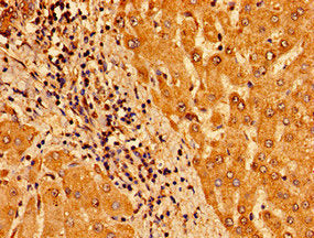 TM6SF2 Antibody
