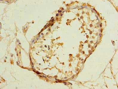 TM7SF3 Antibody