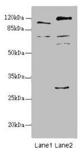 TM9SF1 Antibody