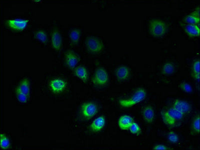 TMEM100 Antibody