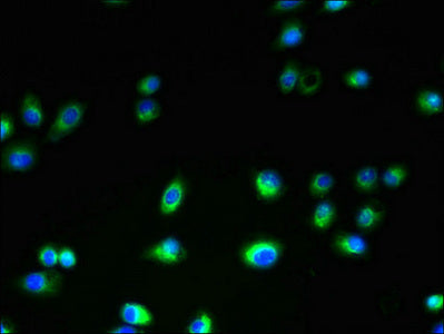 TMEM106A Antibody