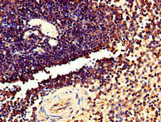 TMEM11 Antibody