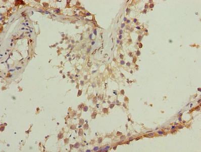 TMEM140 Antibody