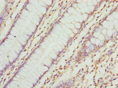 TMEM143 Antibody