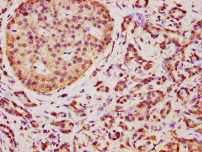 TMEM14A Antibody