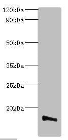 TMEM14B Antibody