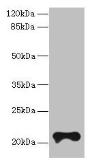 TMEM154 Antibody