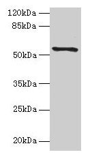 TMEM161A Antibody