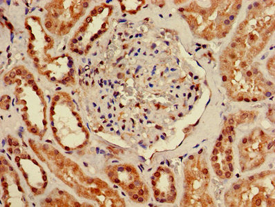 TMEM161B Antibody