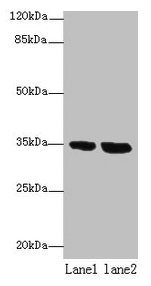 TMEM165 Antibody