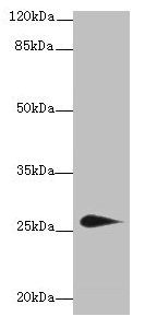 TMEM174 Antibody