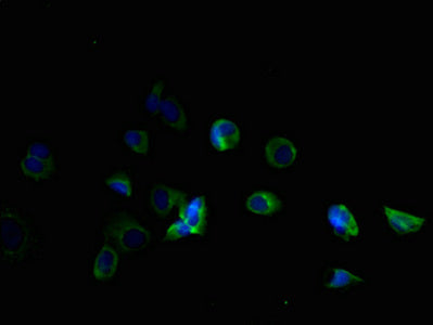 TMEM184B Antibody