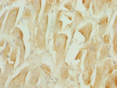 TMEM184C Antibody