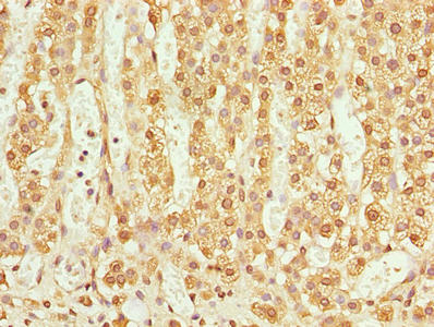 TMEM205 Antibody