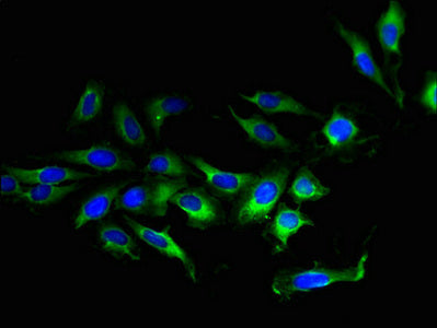TMEM207 Antibody