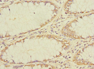TMEM209 Antibody