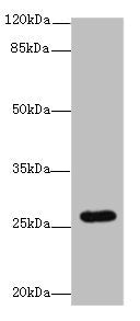 TMEM217 Antibody