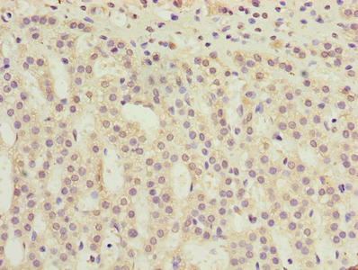 TMEM31 Antibody