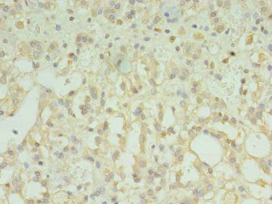 TMEM33 Antibody