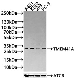 TMEM41A Antibody