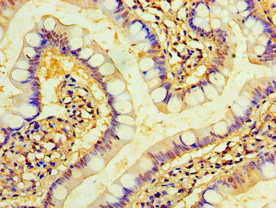 TMEM44 Antibody