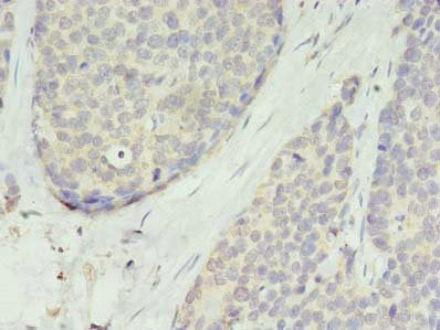 TMEM45A Antibody