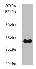 TMEM53 Antibody
