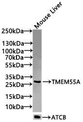 PIP4P2 Antibody