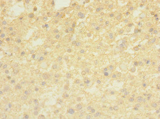 TMEM56 Antibody
