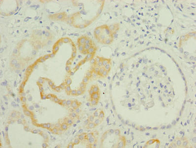 TMEM61 Antibody