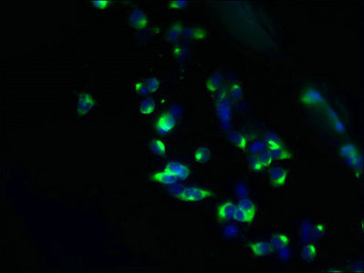 TMEM63A Antibody
