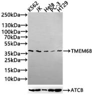 TMEM68 Antibody