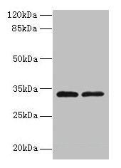 TMEM71 Antibody