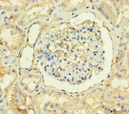 TMEM82 Antibody