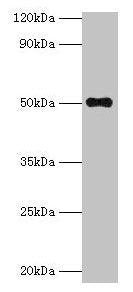 TMLHE Antibody