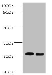TNF Antibody