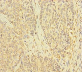 TNFAIP6 Antibody