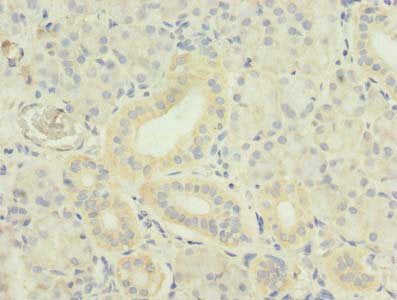 TNFSF12 Antibody