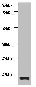 TNNC2 Antibody