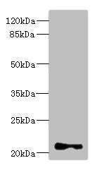 TNNI2 Antibody