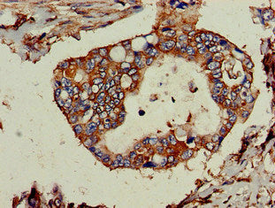TPD52L2 Antibody