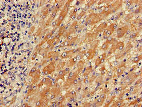 TPM3 Antibody
