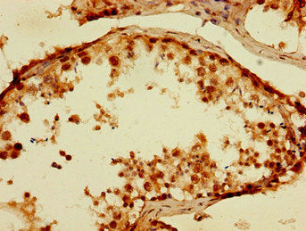 TPSB2 Antibody