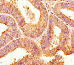 TPST2 Antibody