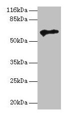 TPTE Antibody