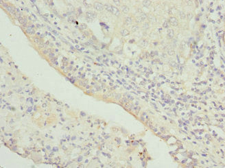 TRAPPC10 Antibody