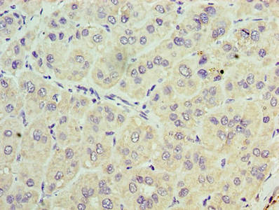 TRBC1 Antibody