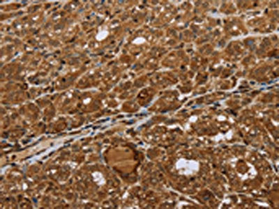 STMN2/STMN3/STMN4 Antibody