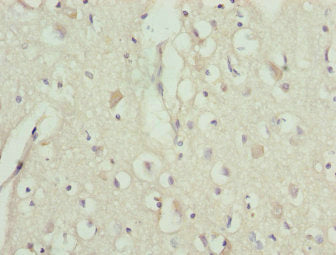 TRIM13 Antibody