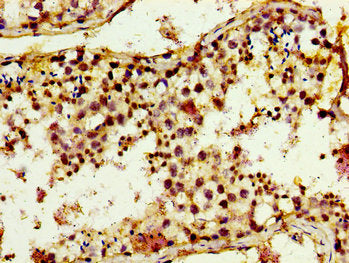 TRIM3 Antibody